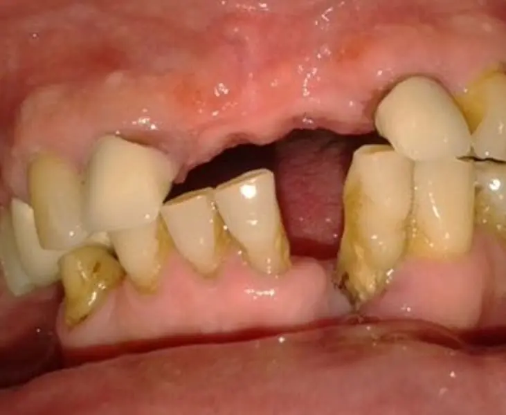 Before