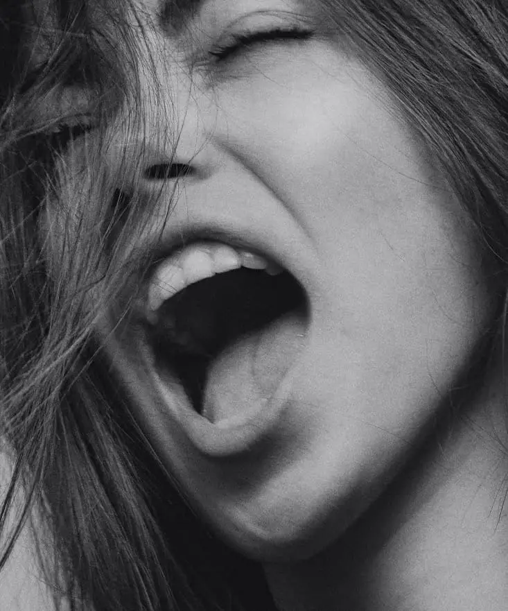 Crooked Teeth
