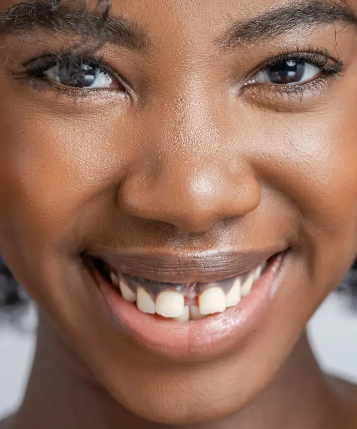 Gappy Teeth