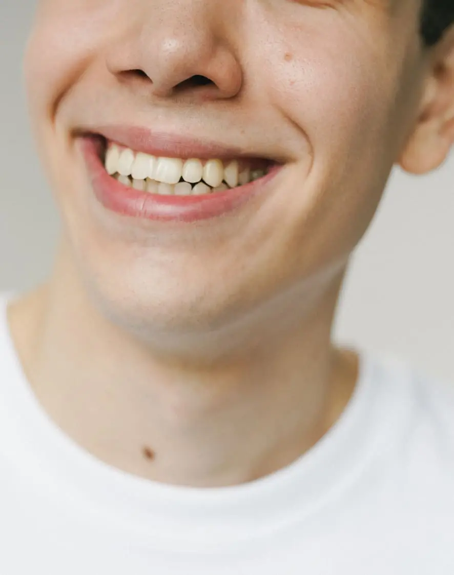 Misshapen Teeth