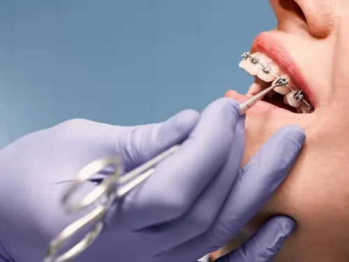 Braces being fitted