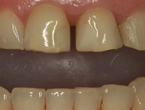 ivonne whitening