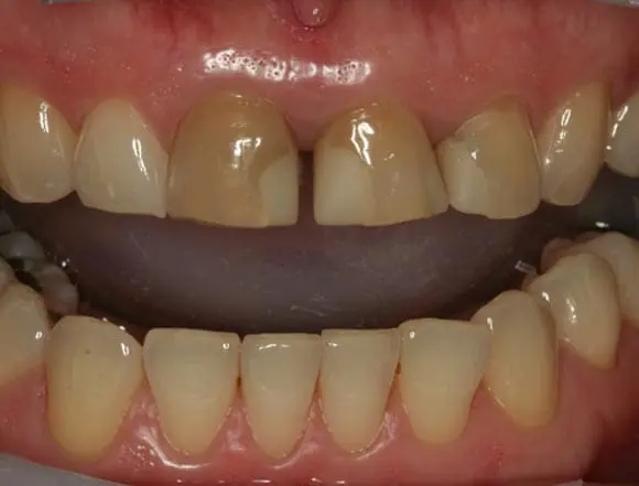 ivonne whitening