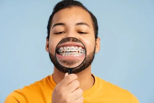 showing close up of metal braces