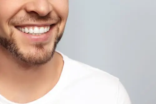 Man with Smile makeover London