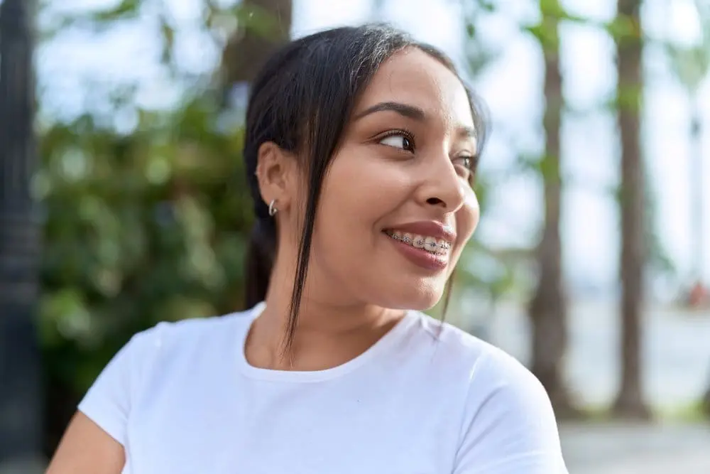 Braces for crossbite treatment