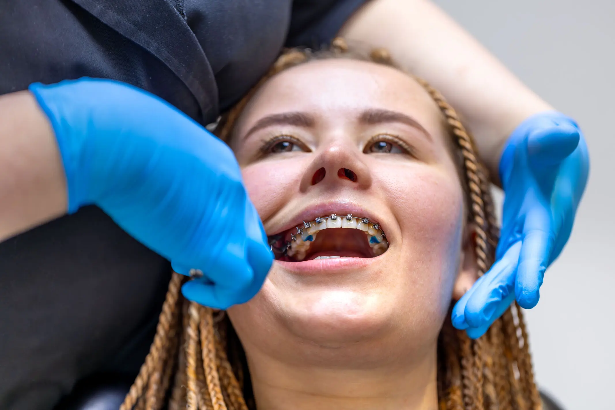 Teeth Straightening London