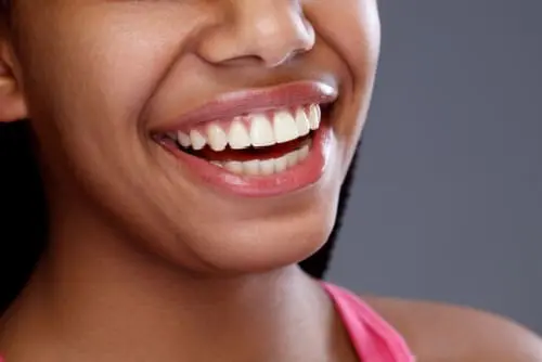 A close-up of a woman's broad, natural smile with white, even teeth