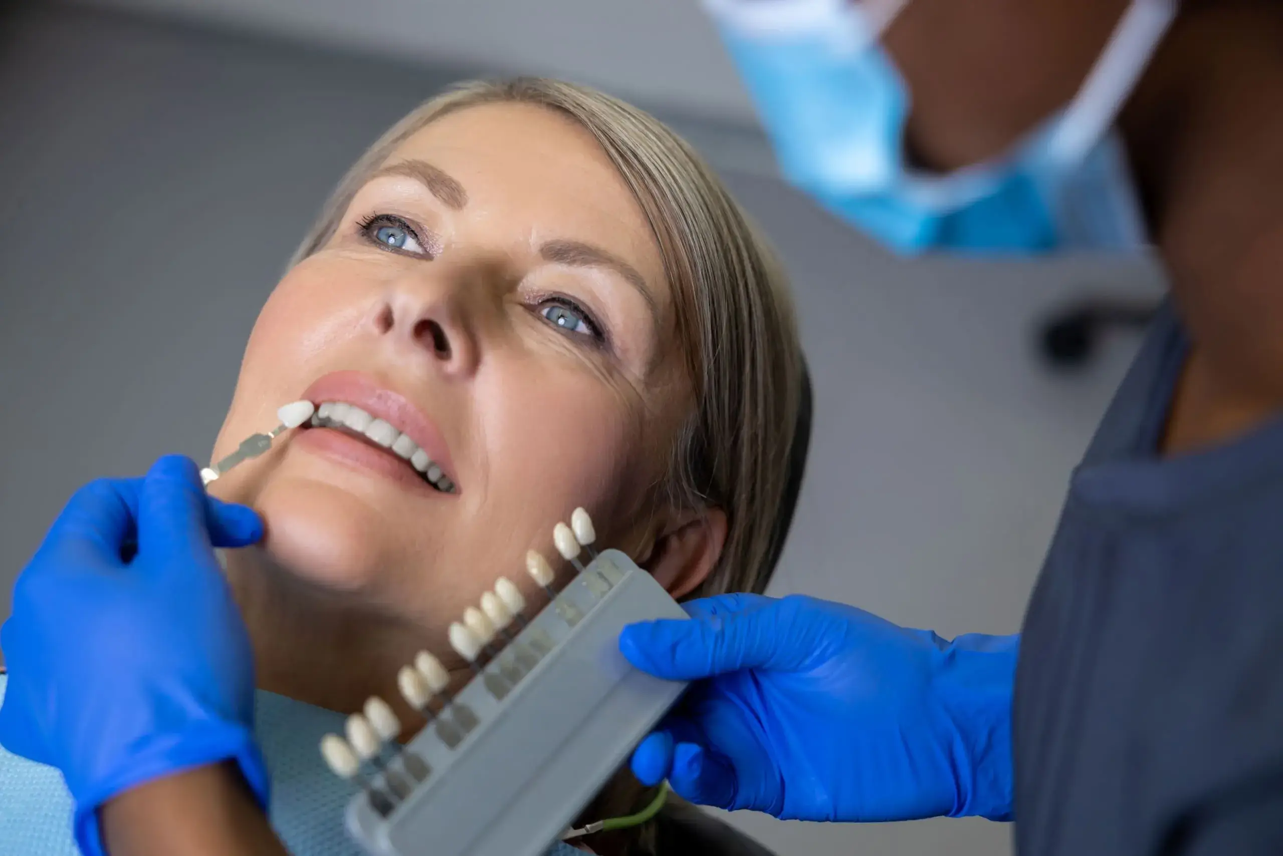A dentist matching tooth shade samples against a patient's smile during a cosmetic consultation